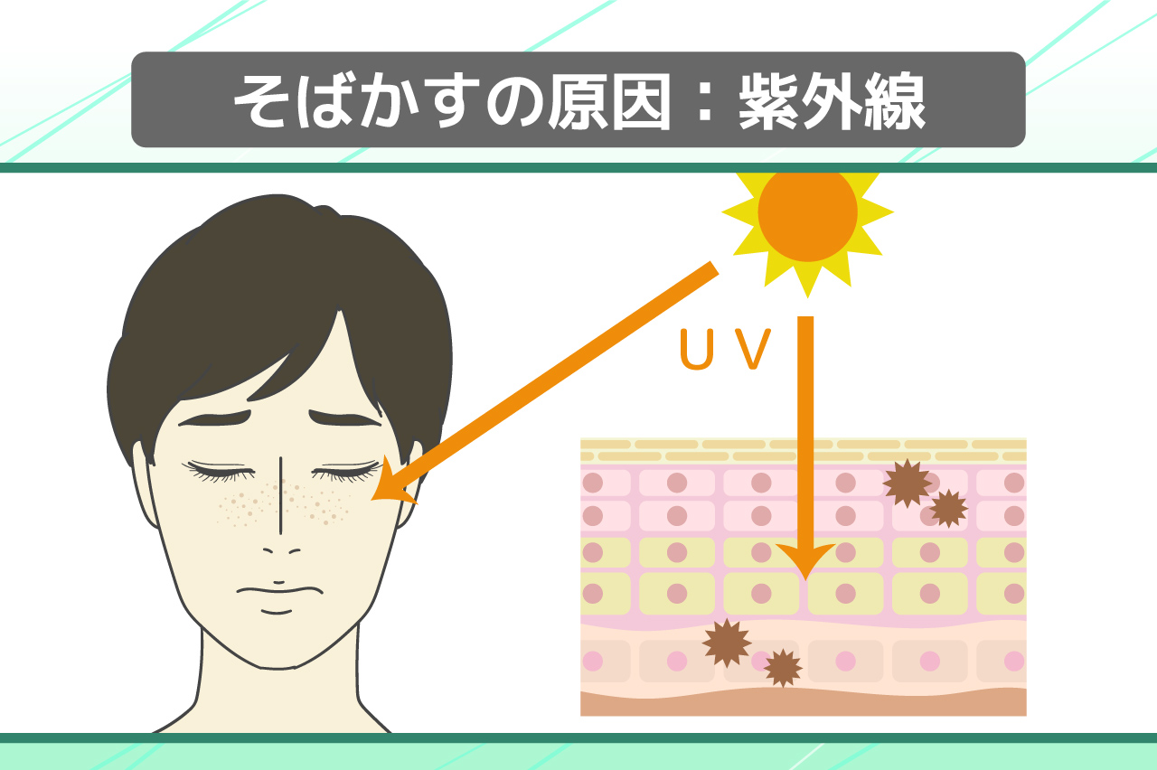 そばかすができる原因